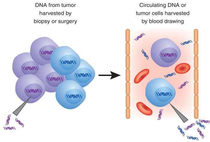 Circulating tumor cells and circulating tumor DNA Vs tumor biopsy Blood based specimens such as circulating tumor DNA and CTCs may