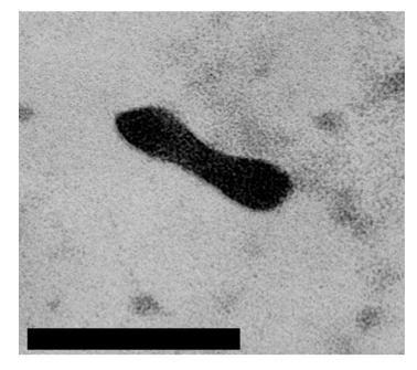 The structures in all TEM images were observed as positive staining expect for the bottom right image observed as negative staining.