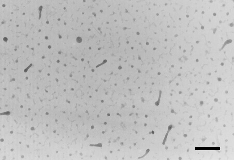 S3 TEM observation of samples with CS addition for extended incubation of 72 h, scale bar: 100 nm.
