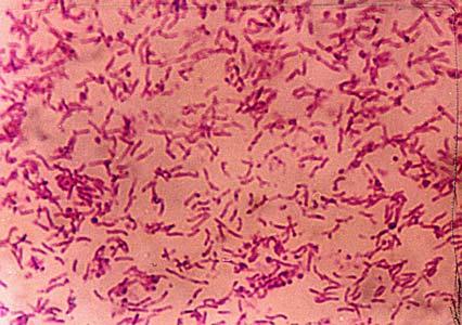 pylori positive antral biopsy (pink colour). Figure 4: Specific primers based urea PCR of H.