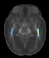 tractography FA template +