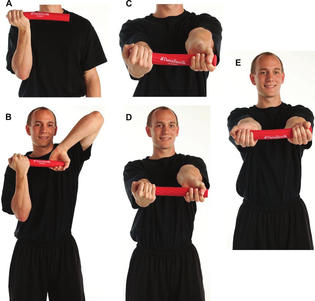 Figure 1. A: Rubber bar held in involved (right) hand in maximum wrist ﬂexion. B: Other end of rubber bar grasped by noninvolved (left) hand.