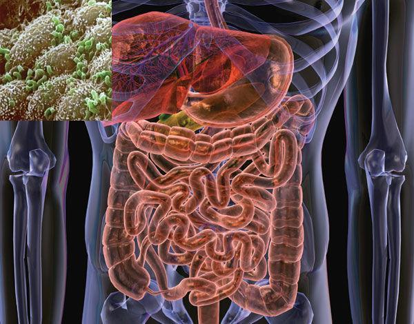 Probiotics and gut health Antibiotic associated diarrhoea (AAD) Clostridium difficile (C diff) Helicobacter pylori Irritable bowel syndrome (IBS) Acute infectious diarrhoea