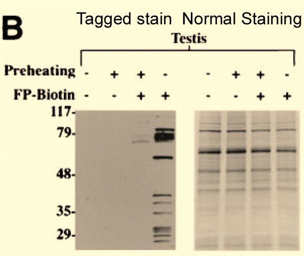 and that staining is tagging reaction time dependent. Here in a tissue sample the staining using the avidin-biotin dependent method is lost when preheated at 80 C for 5 min.
