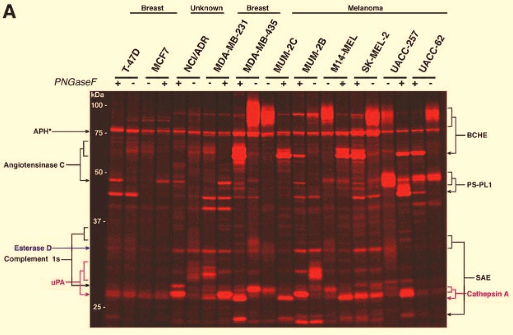This gel shows the results for the secreted proteases. Note the variation in the enzyme upa.