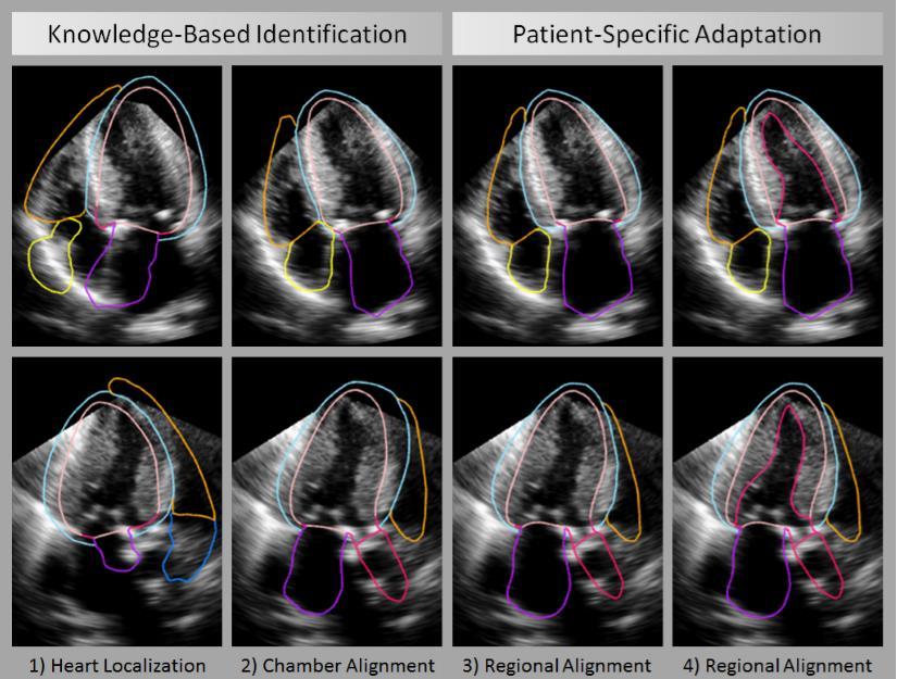 Real-Time Automated Transthoracic Three-Dimensional Echocardiographic