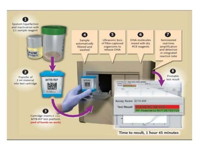 Probe-based tests Xpert MTB/RIF test Fully automated Detects rifampin resistance via detection of the rpob gene Can be used from AFB smear-positive or smear-negative samples in patients who have