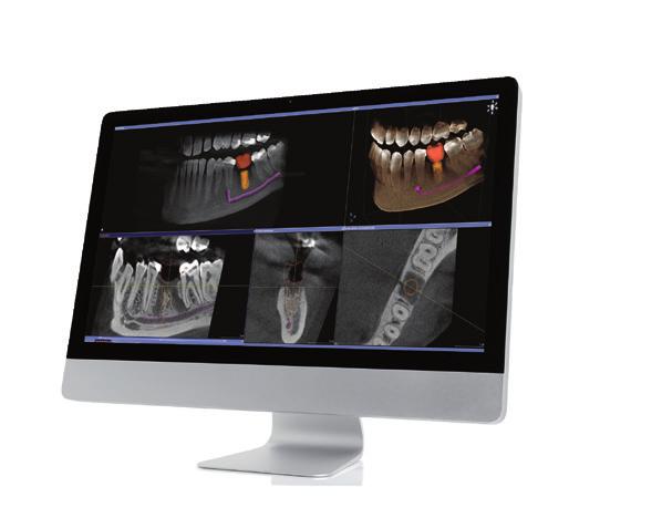 Artifact-Free Image Pedo Collimation TMJ Views Sinus Anterior Thick Slice - P Multislice