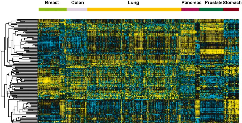 A microrna expression signature of human solid tumors defines cancer gene targets (Volinia S. et al.