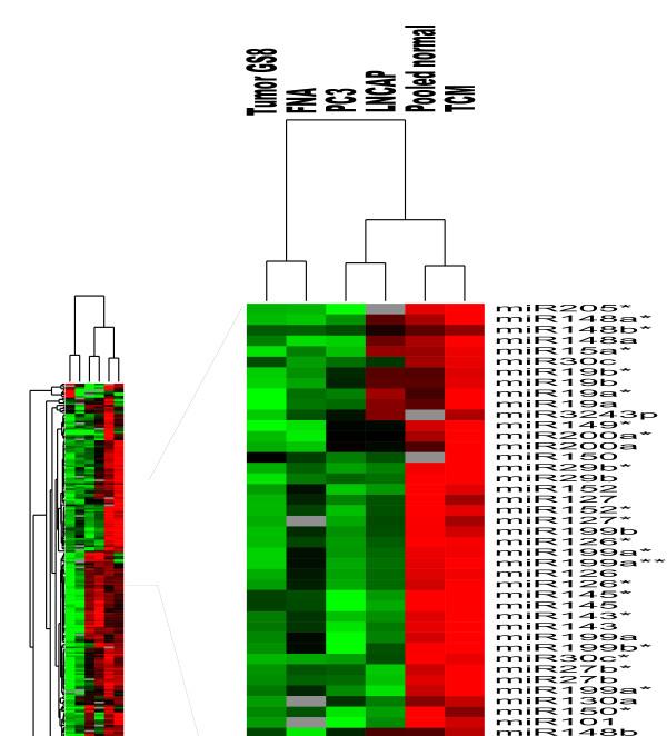 Unsupervised hierarchical clustering of prostate needle core biopsies (Mattie MD et al.