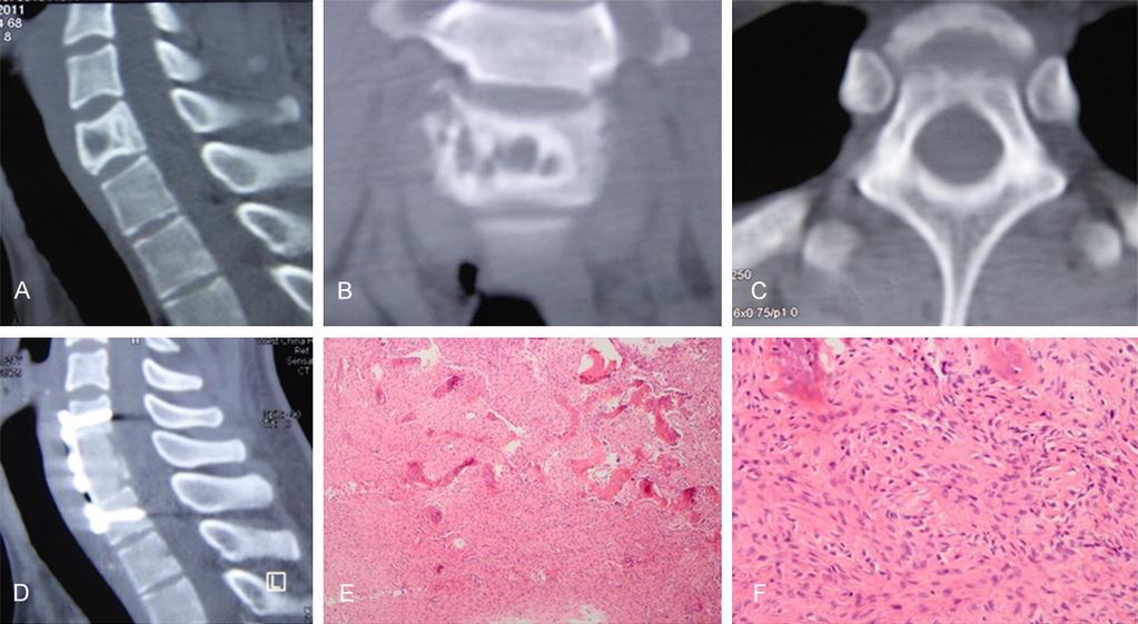 Figure 1. Radiographic and pathological images of case 1.