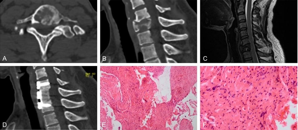 Figure 2. Radiographic and pathological images of case 2.