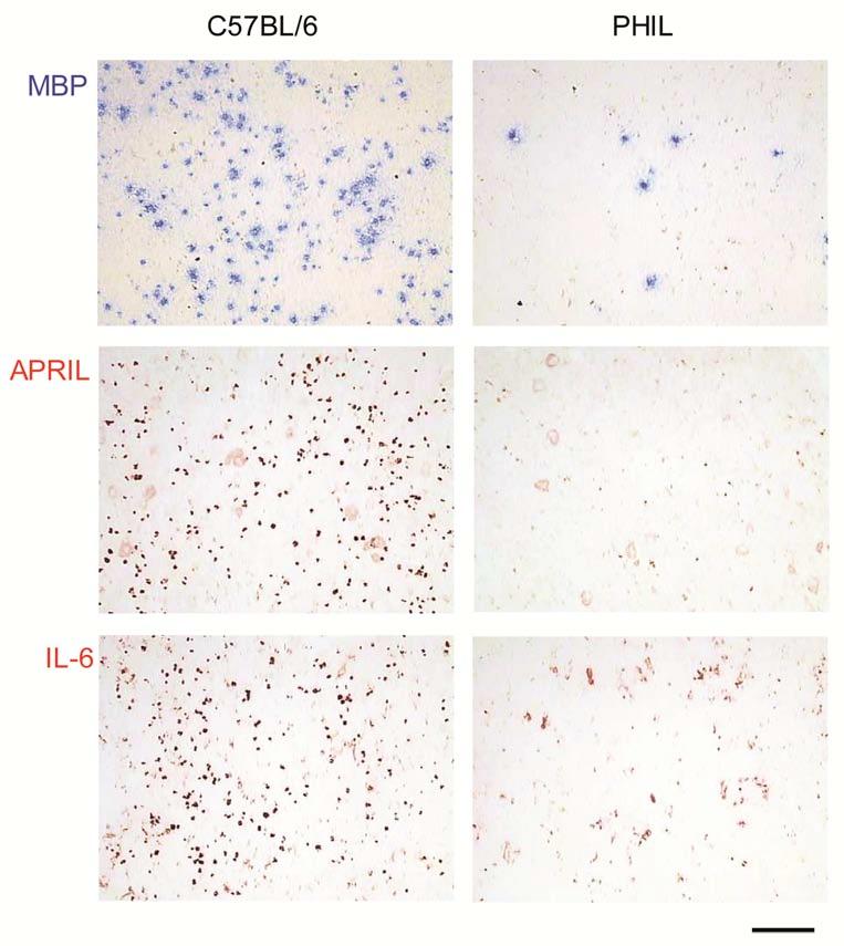 Supplementary Figure 6 The level of APRIL and IL-6 expression is reduced in the BM of PHIL mice.