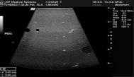 Comparison, (abstract only), J. Ultrasound Med 23: S76, 2004.