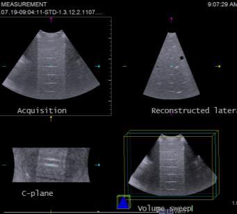 ) May be important for specific uses Images registered from 3-D data sets Workstation measurements Radiation seed implants