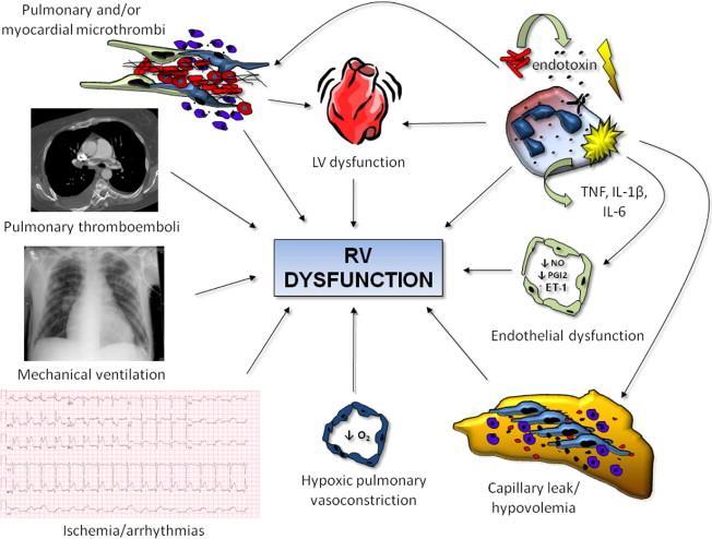 Right ventricular dysfunction Journal of the American