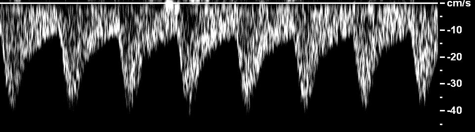 The waveforms are