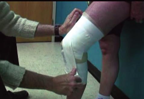 Figure 52: The second half of the split tape is applied just below the inferior border of the patella and then pulled to the medial aspect of the knee.