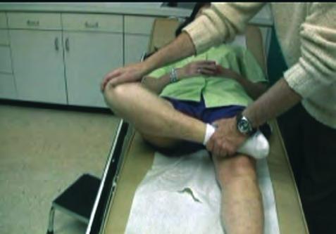 Once reduced and the motion is returned, it is then necessary to tape the knee to restrict full flexion and twisting.