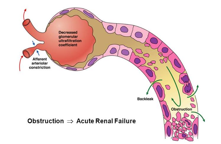 Not all worsening renal failure in treatment of ADHF is the same.