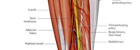 of sciatic nerve