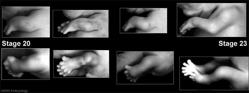 Post rotation embryology.med.unsw.edu.au Upper limb rotates 90 laterally: -extensor mm.