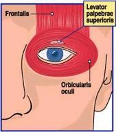 Ptosis is the drooping or falling of the upper eye lid