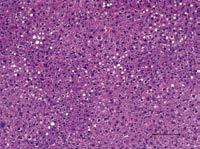 a b c Intestinal neuraminidase activity (mu/mg protein e g j o Serum ceramide (µm) Hepatic triglycerides (mg/g of liver) DANA Naringin Total