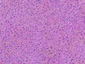 vehicle or withaferin A (125 mg/kg for a d, 2 mg/kg for e, 3 weeks) (a) Representative hematoxylin and eosin (H&E) staining of liver sections