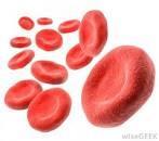 Side effects Bone marrow depression Infection (neutropenia) bruising/bleeding (low platelets) red blood