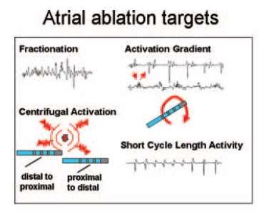 Catheter Ablation of