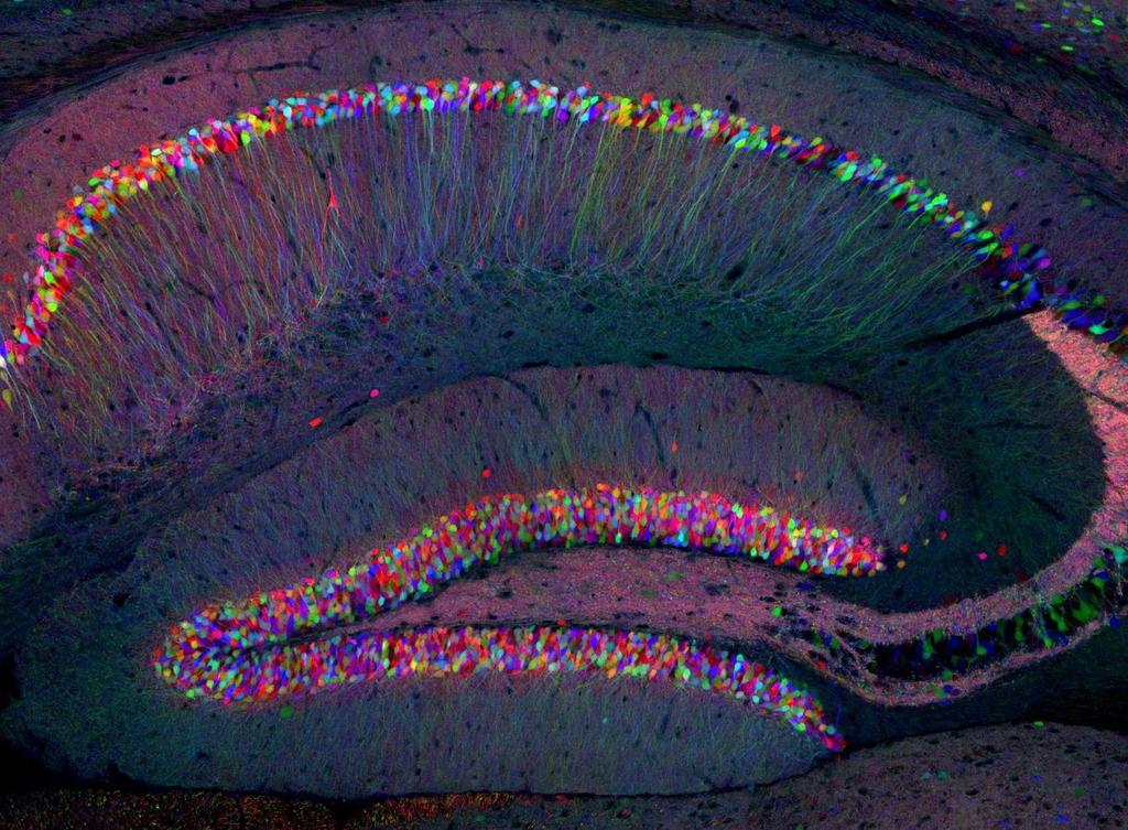 Labeling neurons: Brainbow