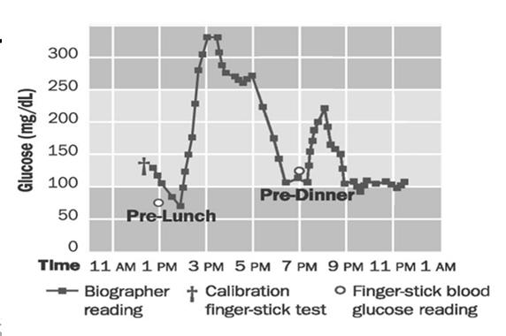 Continuous Glucose Monitoring 19 50% 40% Hyperglycemia is common, especially after meals 30% 20% Breakfast Lunch Dinner 10% 0% < 180 181-240 241-300 > 300 Barbara Davis Center Boland et al, Diabetes