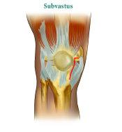 > If the surgeon elects to use a minimally invasive approach, the quadriceps sparing approach can be utilized.