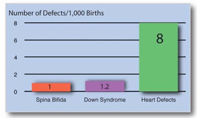 Most Common Birth Defect Most Common CHD Lesions Ventricular septal defect 30% L R shunt Atrial septal defect 10% L R shunt Patent ductus arteriosus 10% L R shunt Pulmonary stenosis 7% Obstructive
