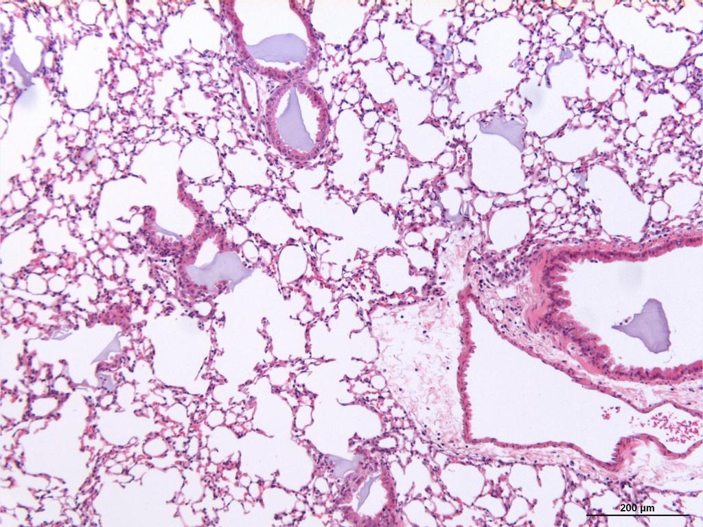 NFC-TE/CTP B2 in mouse lungs NFC In histological samples of the lungs, NFC