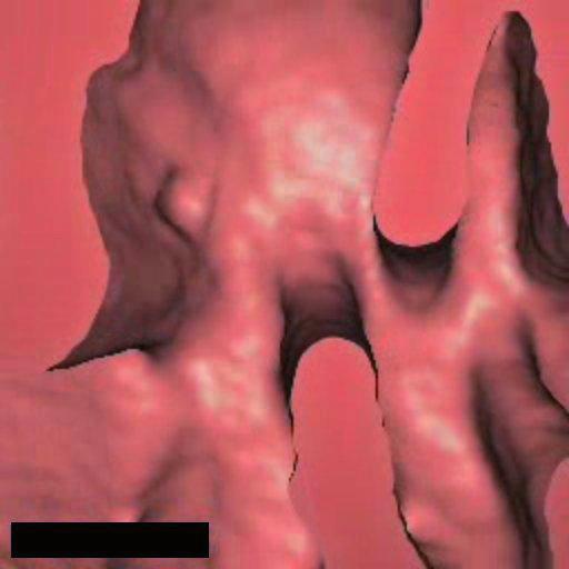 Example of a small polyp.