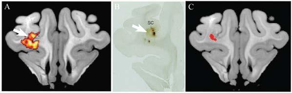 Ex vivo imaging Direct validation of tractography Seed defined from tracer injections Manganese tracer BDA tracer Seed