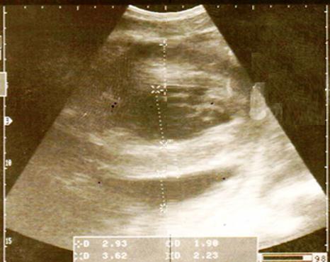 Ultrasonogram of a normal buffalo s heart imaged at