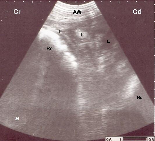 Ultrasonogram of a buffalo with local peritonitis showing corrugated reticulum and
