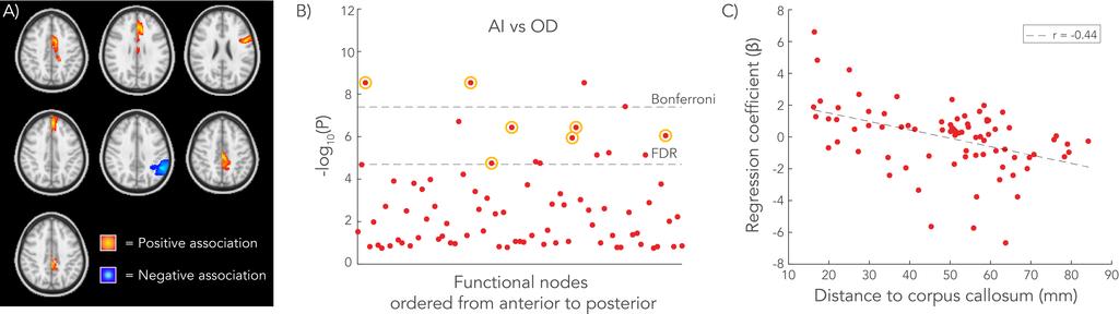 Figure 3. Significant associations between functional AI and OD. A) 7 nodes showed significant associations between AI and OD in both groups. The colormaps depict the ICA-weighting of each node.