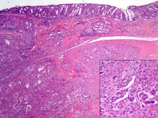4 Journal of Feline Medicine and Surgery Open Reports Figure 4 (a) Histopathology of the skin: moderate epidermal hyperplasia, atrophic, mostly telogen and kenogen hair follicles.