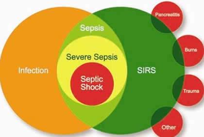 Concern of previous definitions of sepsis Excessive focus on inflammation Misleading model that sepsis