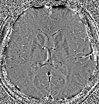 7 BOLD MRV of a human brain acquired at 3T MR scanner.