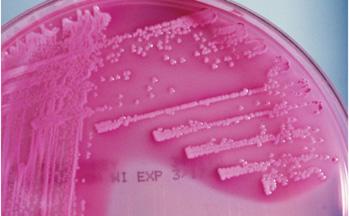 of salt tolerant bacteria MacConkey agar For isolation of Gram-negative