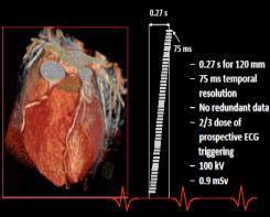SCCT guidelines on radiation dose and dose-optimization strategies in cardiovascular CT. Journal of Cardiovascular Computed Tomography, vol. 5, no. 4, pp. 198-224.