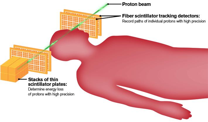 Proton CT scans have the potential to create more precise maps of a patient's body. Fiber scintillator tracking detectors placed next to the patient precisely record the protons' paths.
