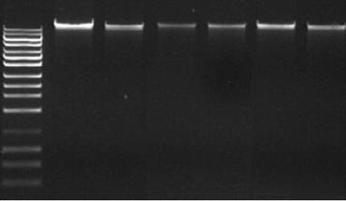 Gel electrophoresis of DNA M 1 2 3 4 5 6 12000-5000- 2000-1650 - 1000-850 - 650-500 - 400 - Gel electrophoresis of bacterial genomic DNA.
