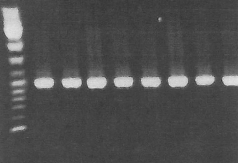 M 1 2 3 4 5 6 7 8 3000-2000 - 1000-800 - 600-500 - Electrophoresis in 1 % agarose gel of PCR products.