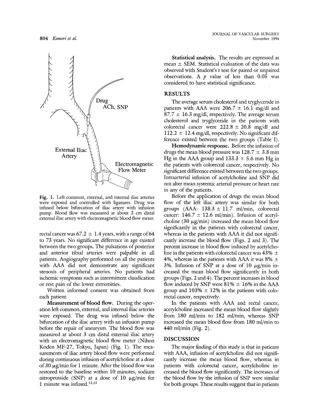 804 Komori et al November 1994 k,. / x. /,. / J /" /'~ ~/~Drug External Ililc~ "~'~, Artery }-!t ~ Electromagnetic ~ ~ w Meter Fig. 1. Left common, external, and internal iliac arteries were exposed and controlled with ligatures.